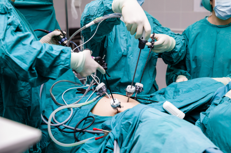 Laparoscopic Surgery